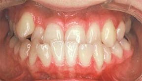 ortho;  Team Leatherman Care Dentistry, Lorain, OH 44053