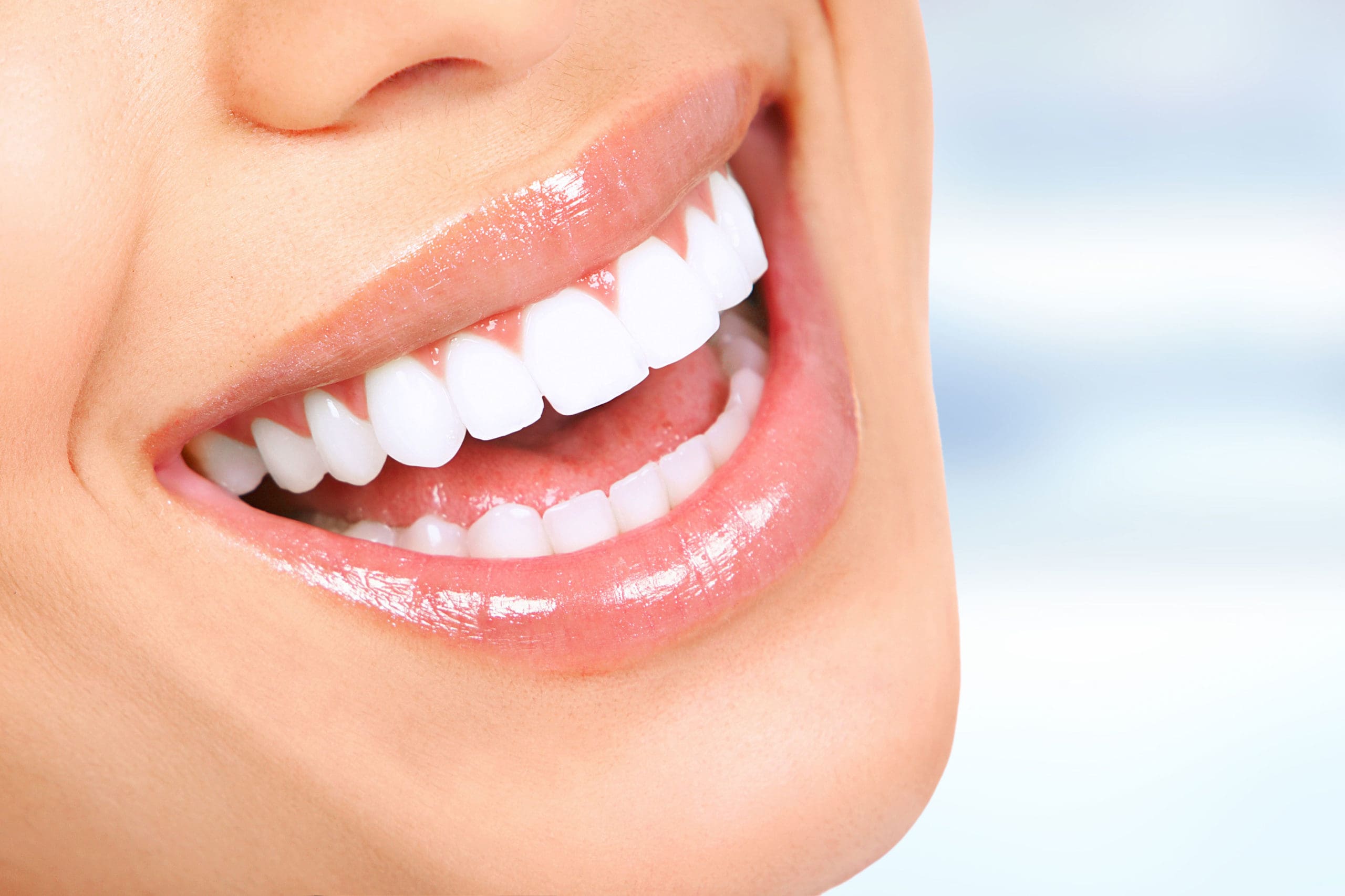 teeth whitening;  Team Leatherman Care Dentistry, Lorain, OH 44053